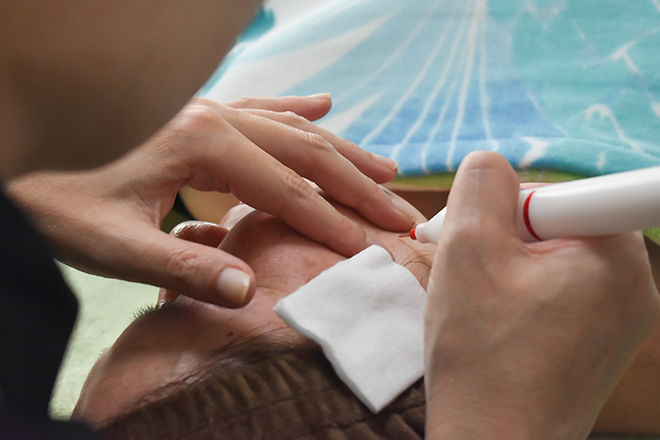 口コミで大人気！新たに導入された「シミケアマシーン」で−１０歳を実現♪